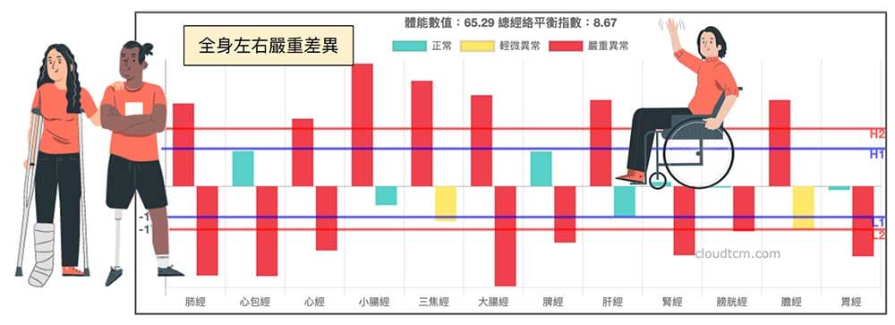 全身性的左右嚴重差異,一般人不容易見到