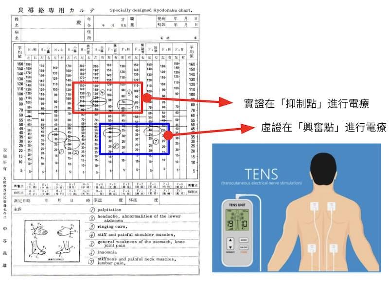 原始的良導絡判讀與療法是很簡單的