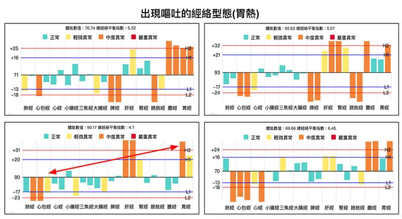 胃熱嘔吐經絡型態,可見胃經實證,心包經虛證
