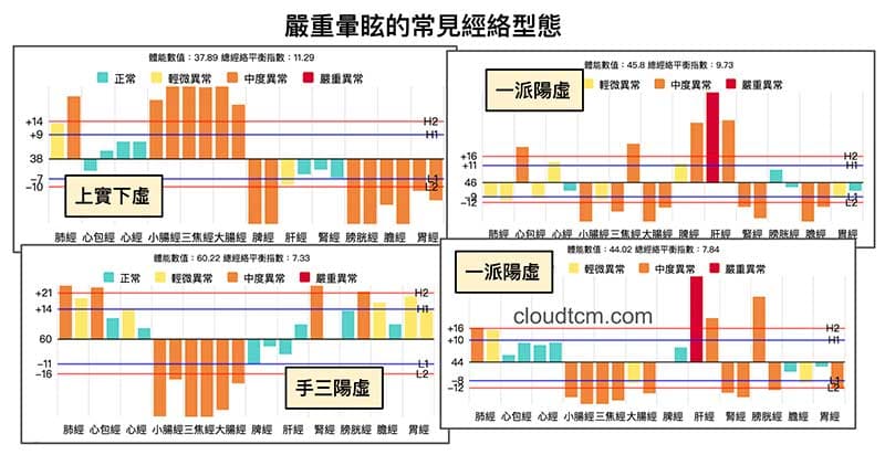 嚴重暈眩的經絡型態,可以看到陽經能量明顯不足