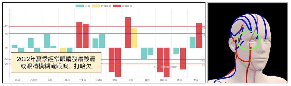 夏季眼睛乾癢視力模糊，透過3D經絡理解