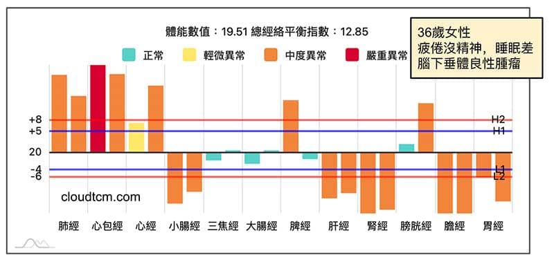 腦下垂體良性腫瘤案例