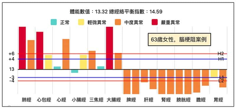女性腦梗塞案例