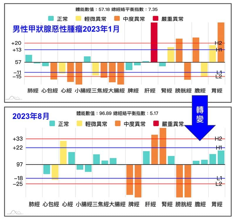 甲狀腺惡性腫瘤經絡型態變化
