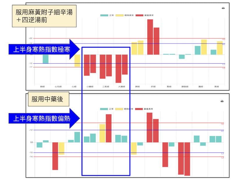 服用中藥麻黃附子細辛湯＋四逆湯之後比較經絡差異