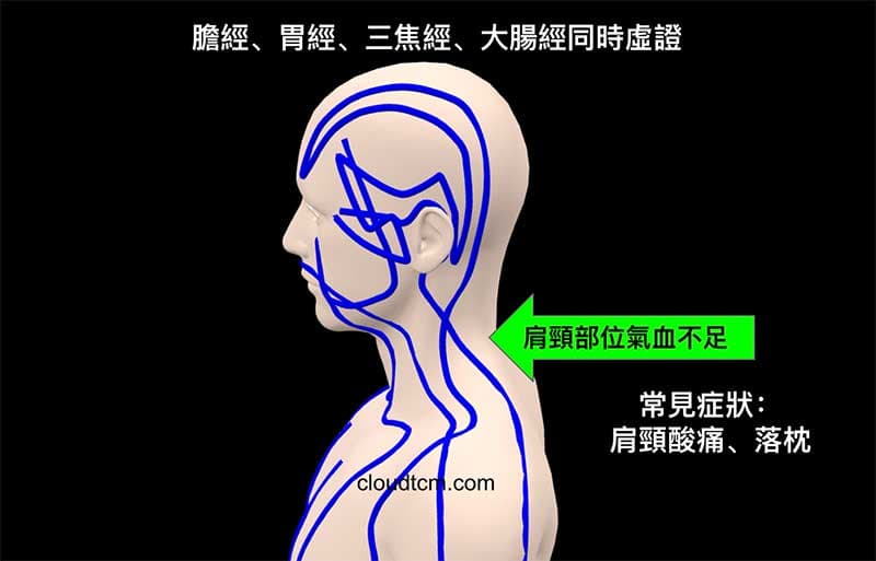 少陽經、陽明經虛證時容易出現肩頸酸痛