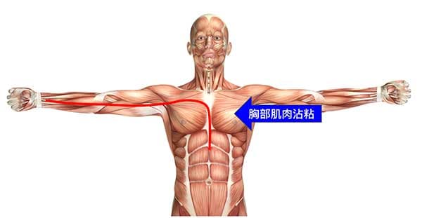 長期心包經異常，胸部肌肉出現沾粘