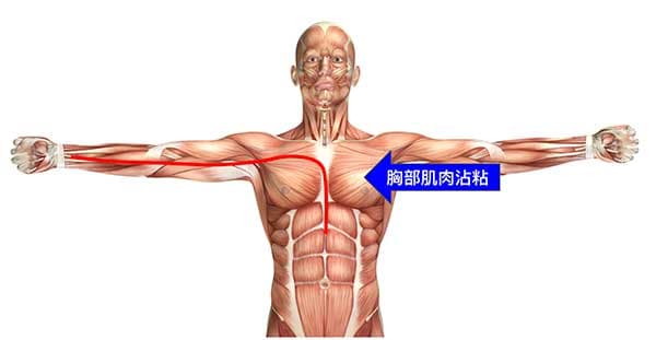 長期心包經異常,胸部肌肉出現沾粘