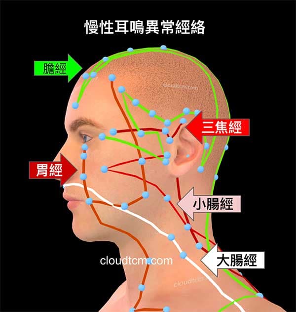 慢性耳鳴案例的異常經絡