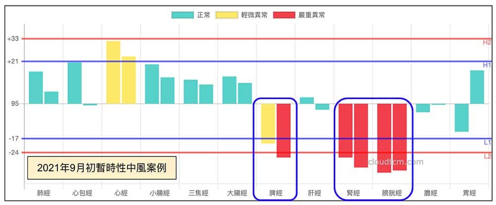 暫時性中風經絡