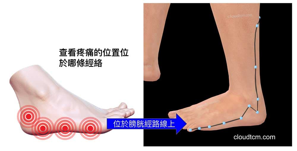 查看疼痛的位置,位於哪條經絡路線