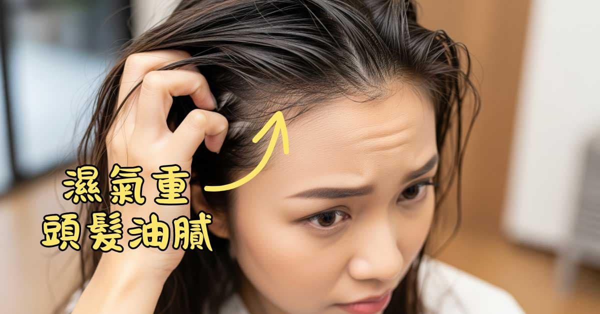 體內濕氣重的人頭髮經常油膩