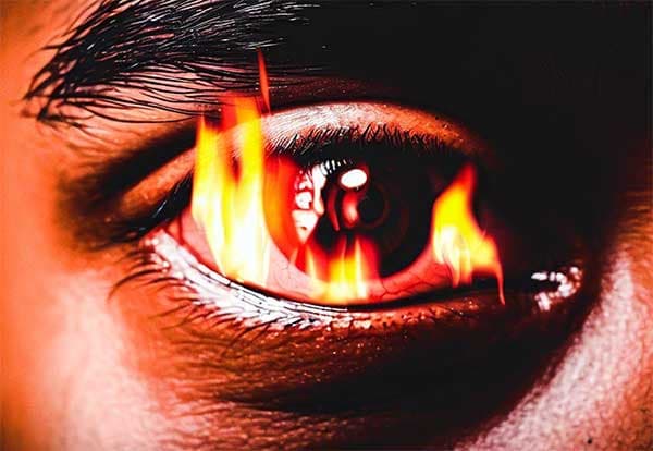 火熱之氣影響經絡，容易造成眼睛發炎