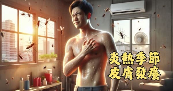炎熱季節非容易出現皮膚癢