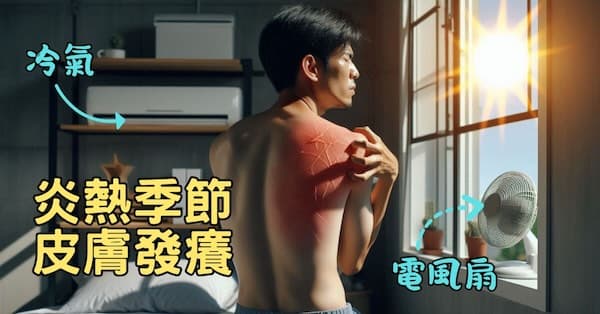 在炎熱季節下,特別容易出現皮膚搔癢