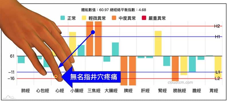 三焦經出現實證的時候,無名指的井穴有機會出現疼痛