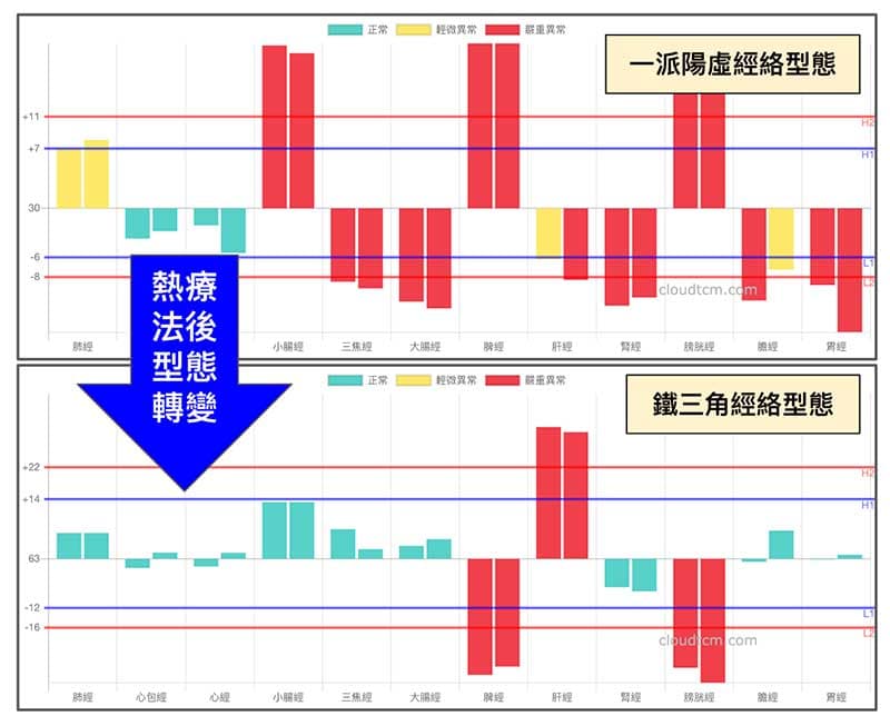 有一定比例的人,在熱療之後出現鐵三角經絡型態
