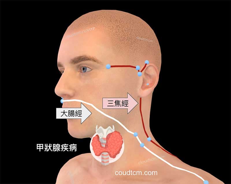 甲狀腺疾病與三焦經、大腸經密切相關