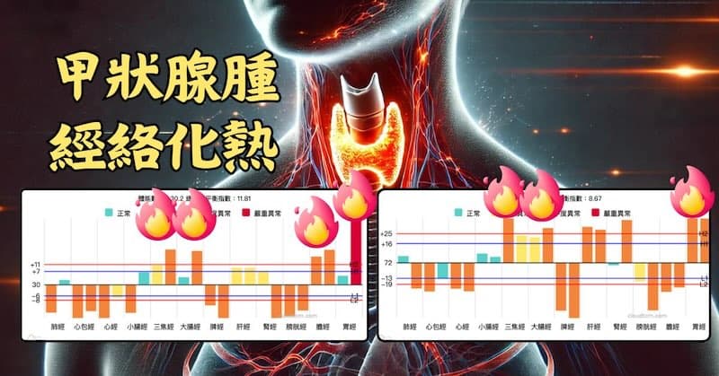 甲狀腺腫的人,經絡通常是化熱的狀態