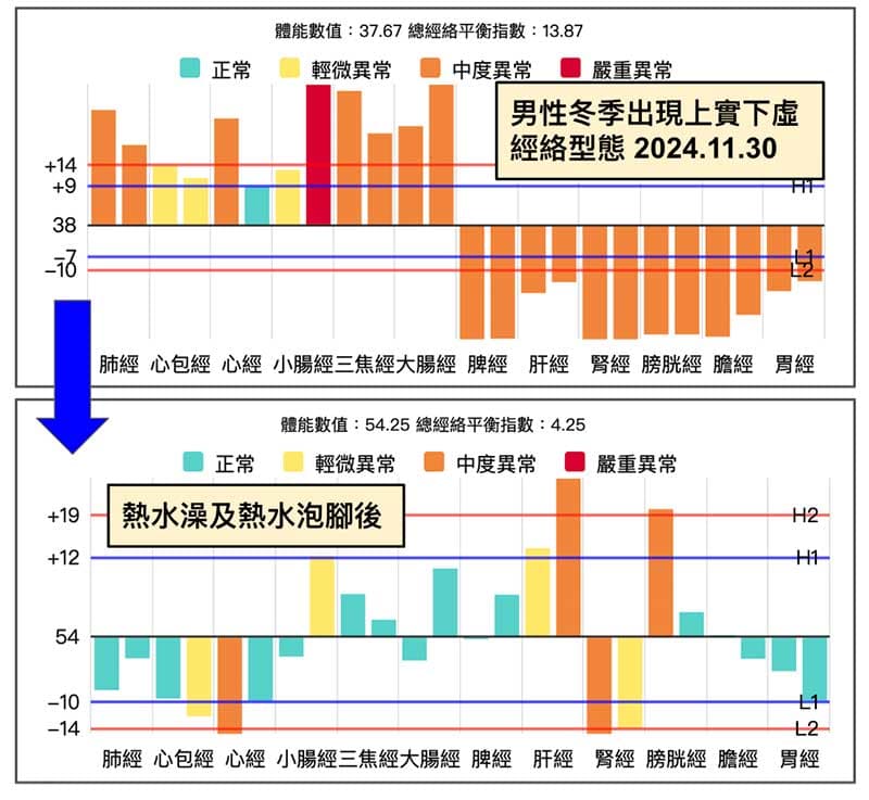 男性比較熱水泡腳前後的經絡型態