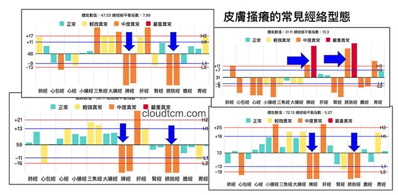 皮膚搔癢常見的經絡型態