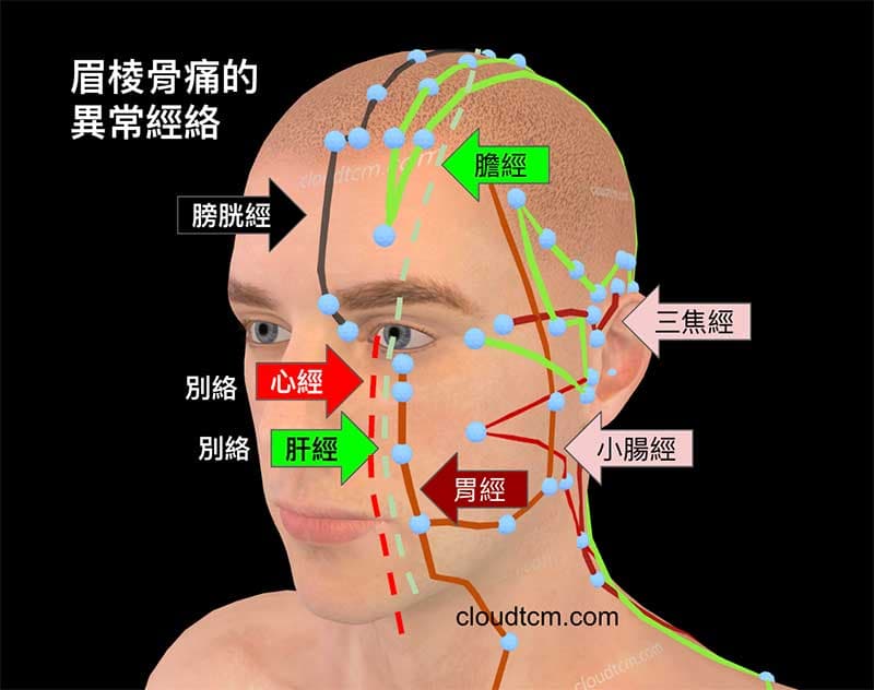 造成眉棱骨痛的異常經絡