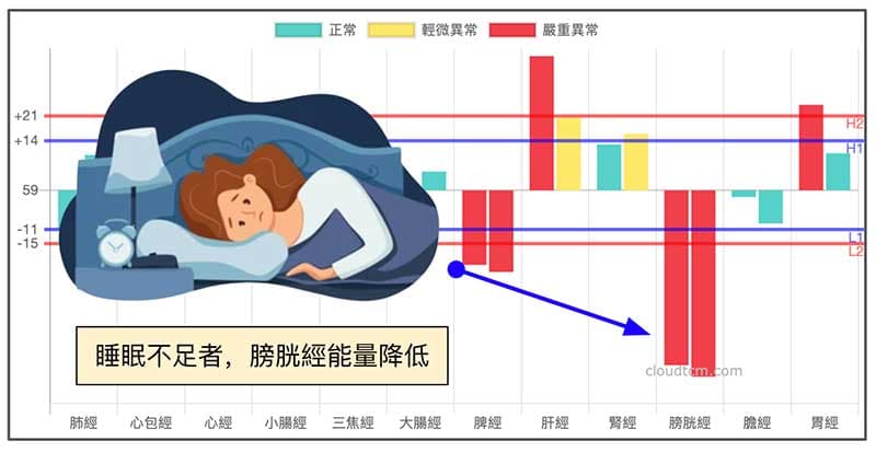 睡眠不足者，膀胱經能量低下