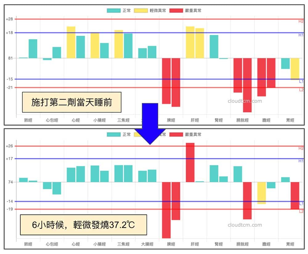 輕微發燒的經絡現象