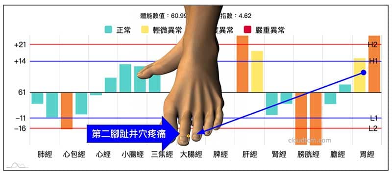 胃經實證時,第二腳趾井穴附近容易出現疼痛