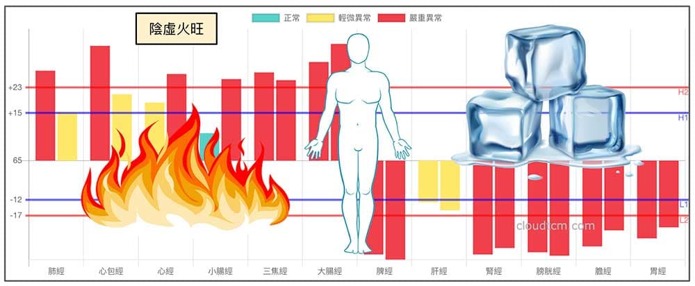 綜和經絡體質，難逃陰虛火旺的魔掌