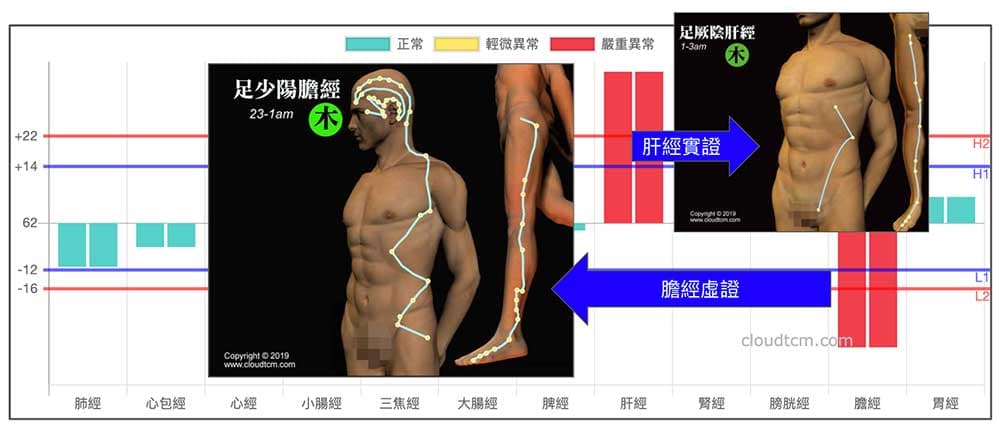 肝經實證膽經虛證,長期表裡不平衡