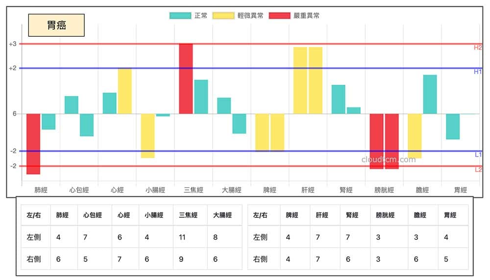 胃癌低體能數值