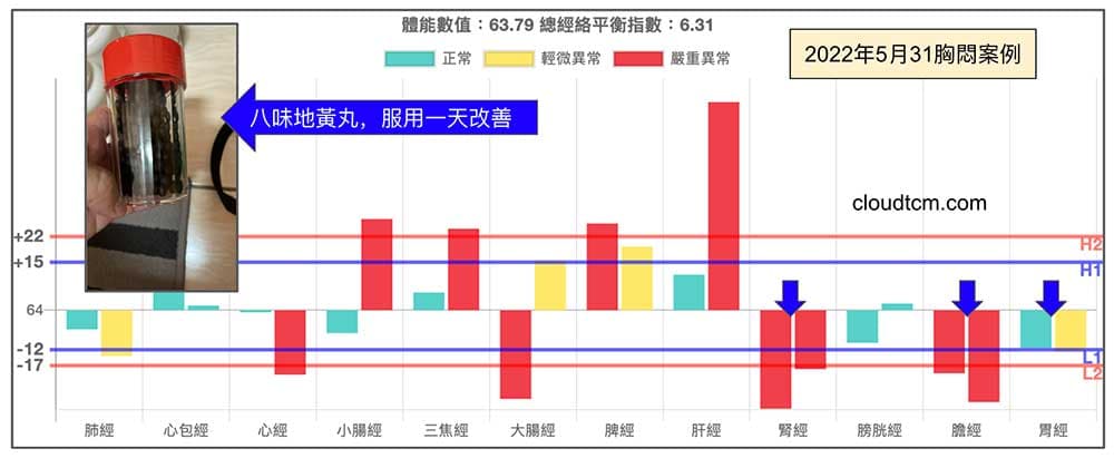 腎陽虛胸悶氣喘,服用八味地黃丸快速改善!