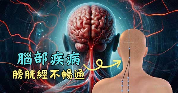 膀胱經不暢通的人,容易罹患腦部疾病