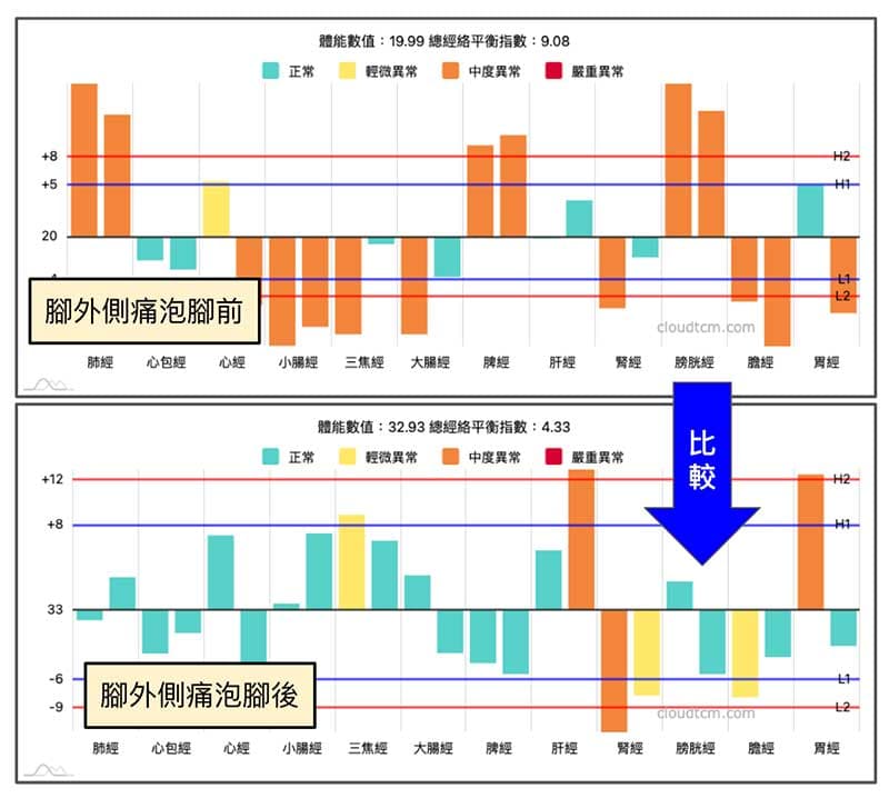 腳外側痛,泡腳後比較前後經絡差異