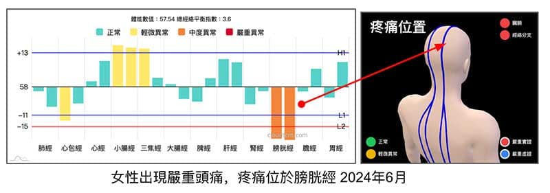 女性出現嚴重頭痛,位於膀胱經上