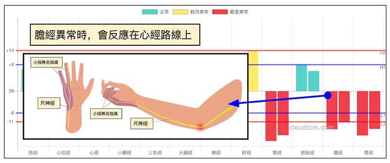 膽經異常的時候,也會反映在心經路線上