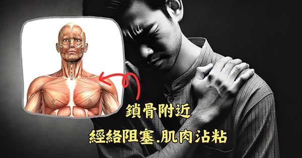 鎖骨附近經絡組塞,肌肉沾粘容易出現疼痛
