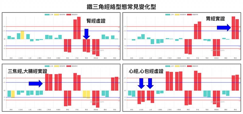 鐵三角經絡型態常見變化類型