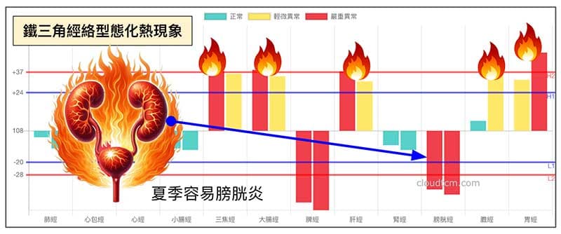 夏季鐵三角經絡型態,體內火氣大容易出現膀胱炎