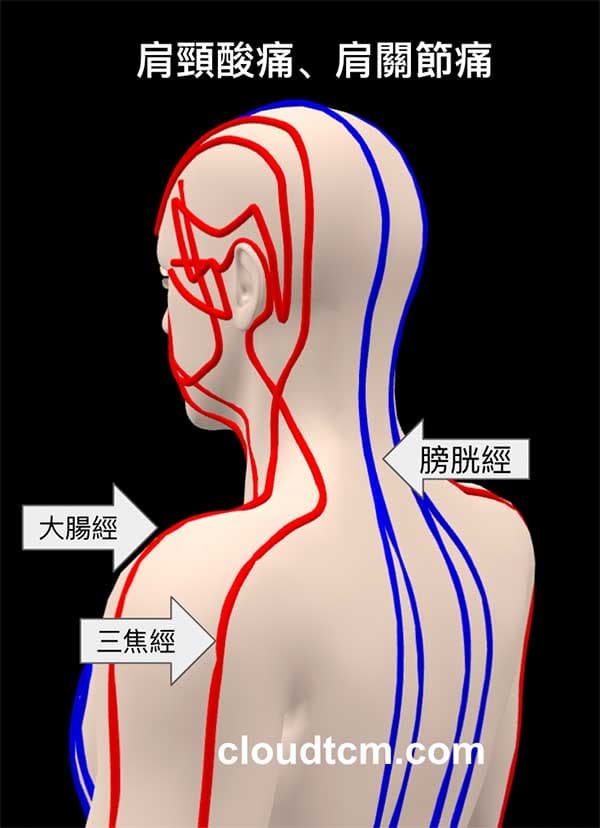 鐵三角經絡型態容易肩頸酸痛