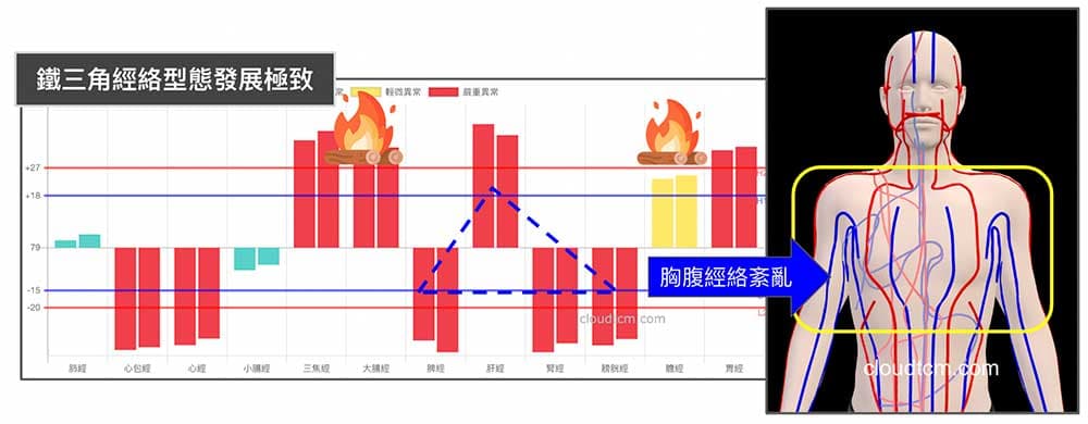 鐵三角經絡型態極致，胸腹部經絡紊亂