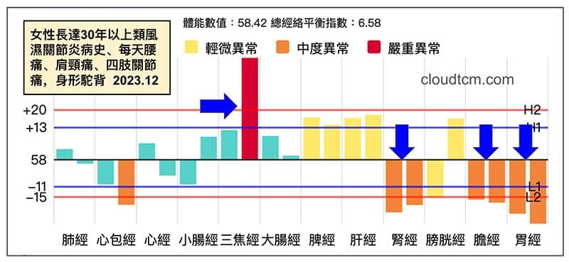 30年以上的類風濕關節炎病史的經絡型態