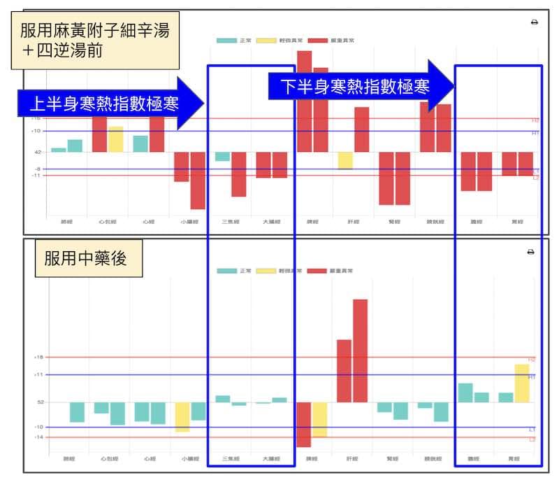 服用中藥麻黃附子細辛湯＋四逆湯之後比較經絡差異