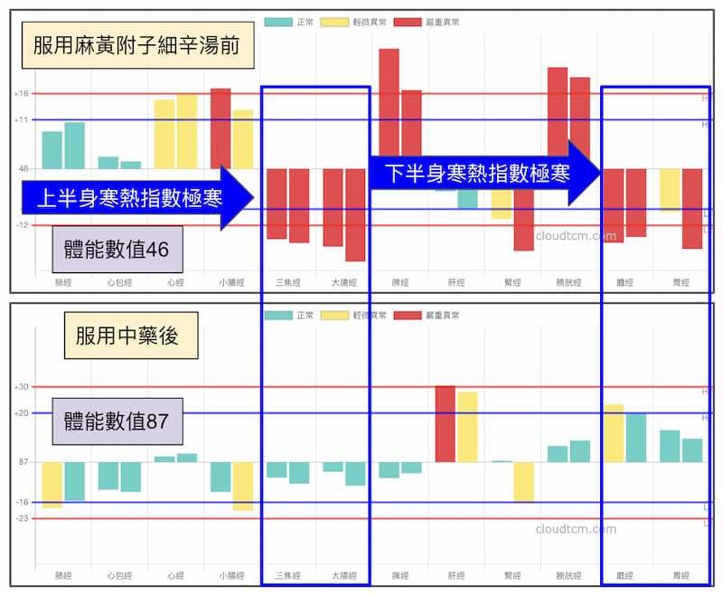 服用中藥麻黃附子細辛湯之後比較經絡差異