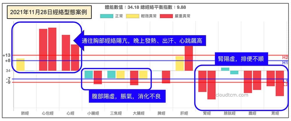 從經絡圖可以輕易理解症狀的原因