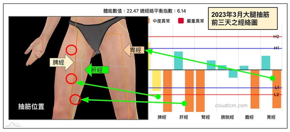 2023年春季腳抽筋位置在三天前即可預測