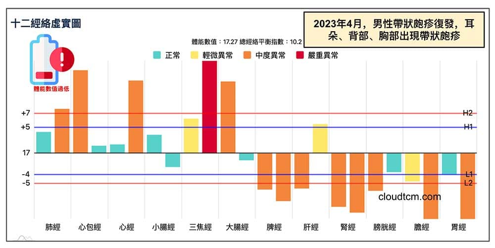 天氣溫度下降出現帶狀皰疹案例