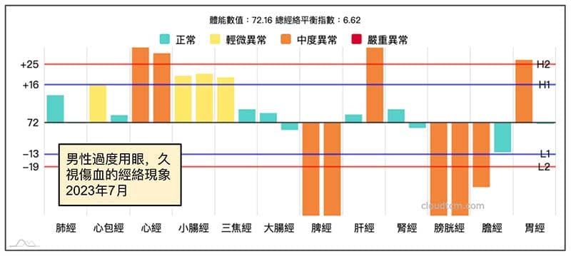 一天用眼超過15小時，久視傷血案例