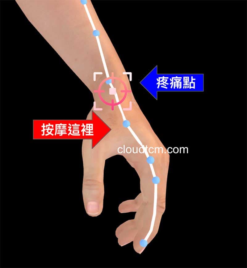 按摩合谷穴,改善媽媽手疼痛